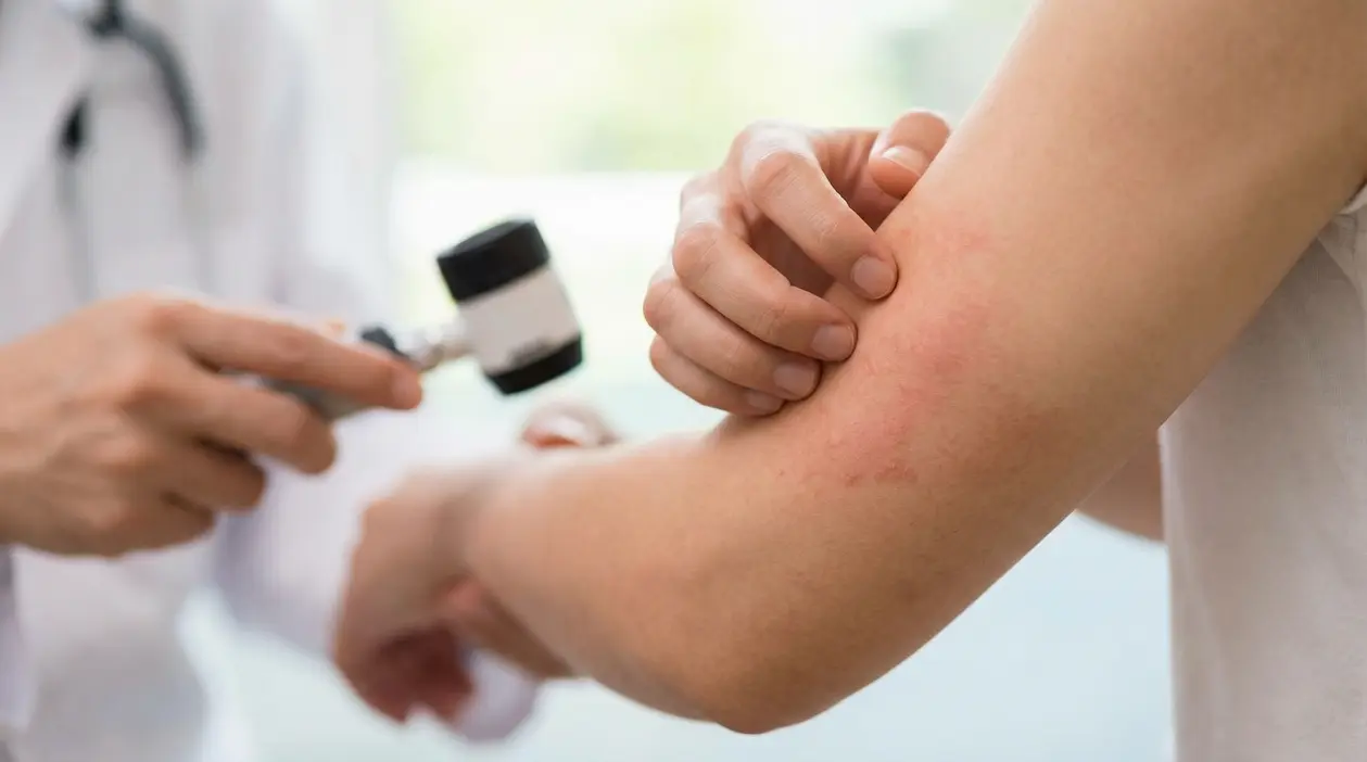 Persona mostra irritazione cutanea a un medico durante una visita dermatologica